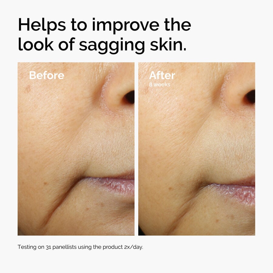 caffeine-3-escin-1-face-serum-n4 ord-caffeine-3pct-escin-1pct-face-serum-before-after-sagging.jpg