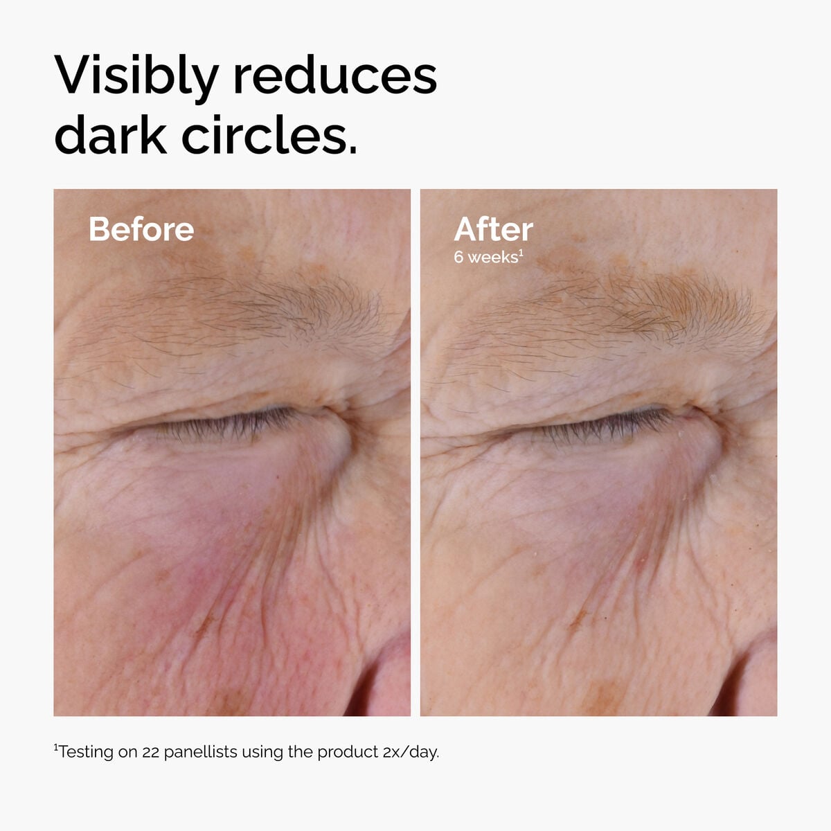 caffeine-solution-5-egcg-eye-serum-z4 ord-caffeine-solution-egcg-dark-circles-before-after.jpg