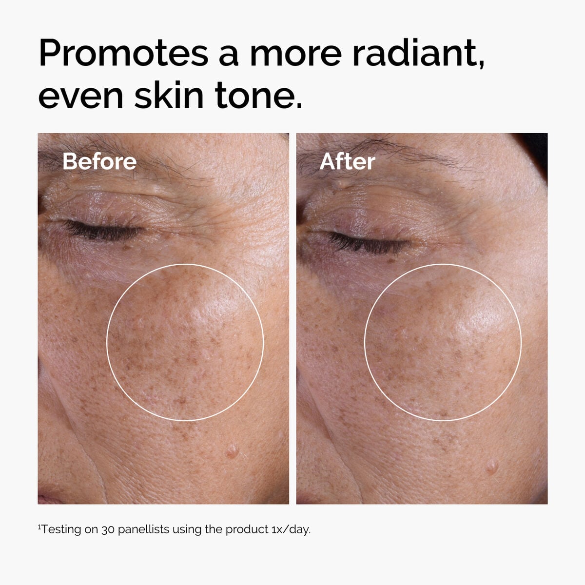glycolic-acid-7-exfoliating-toner-i0 ord-glycolic-before-after-radiance.jpg