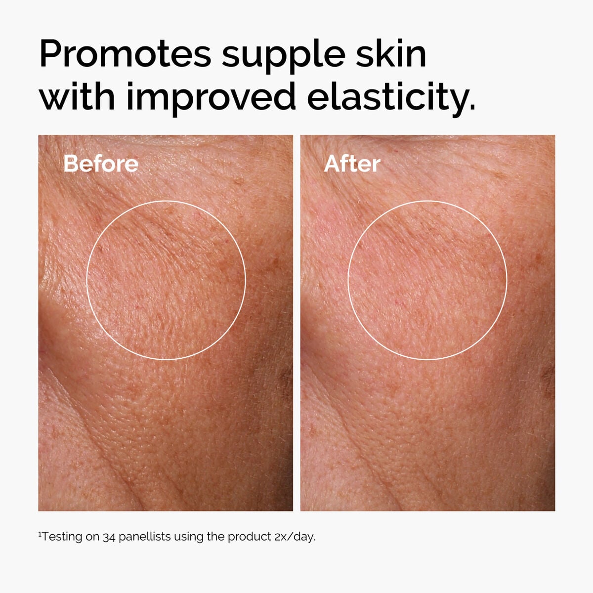 hyaluronic-acid-2-b5-with-ceramides-q0 ord-hyaluronic-acid-2pct-b5-hydrating-serum-before-after-elasticity.jpg