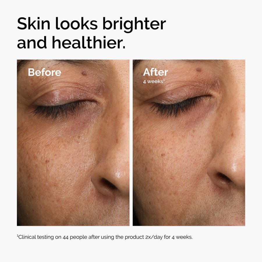 multi-antioxidant-radiance-serum-l4 ord-mars-before-after-healthy.jpg