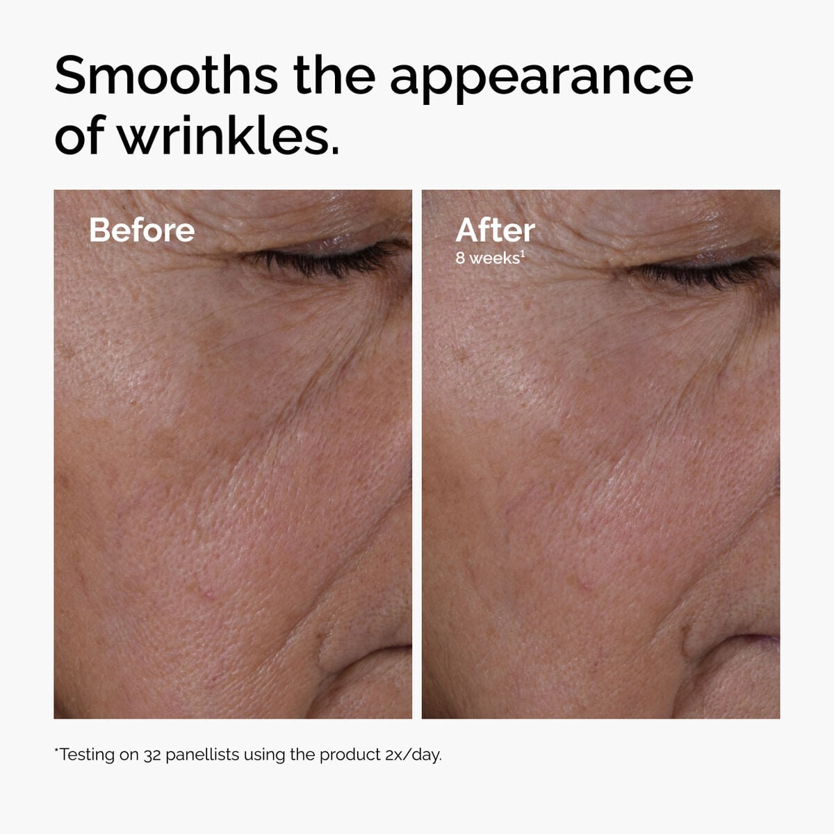 multi-peptide-ha-serum-x1 ord-multi-peptide-ha-serum-wrinkles-before-after.jpg