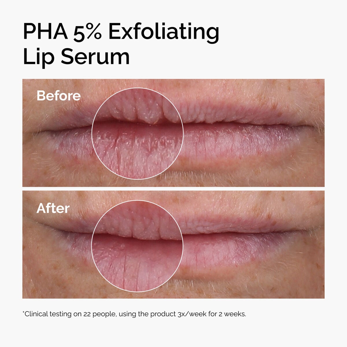 pha-5-exfoliating-lip-serum-o1 ord-pha-5pct-lip-exfoliating-serum-before-after.jpg