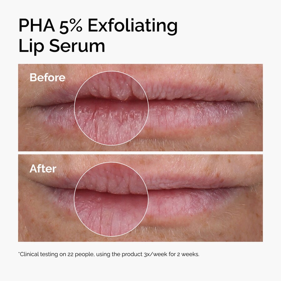 pha-5-exfoliating-lip-serum-o1 ord-pha-5pct-lip-exfoliating-serum-before-after.jpg